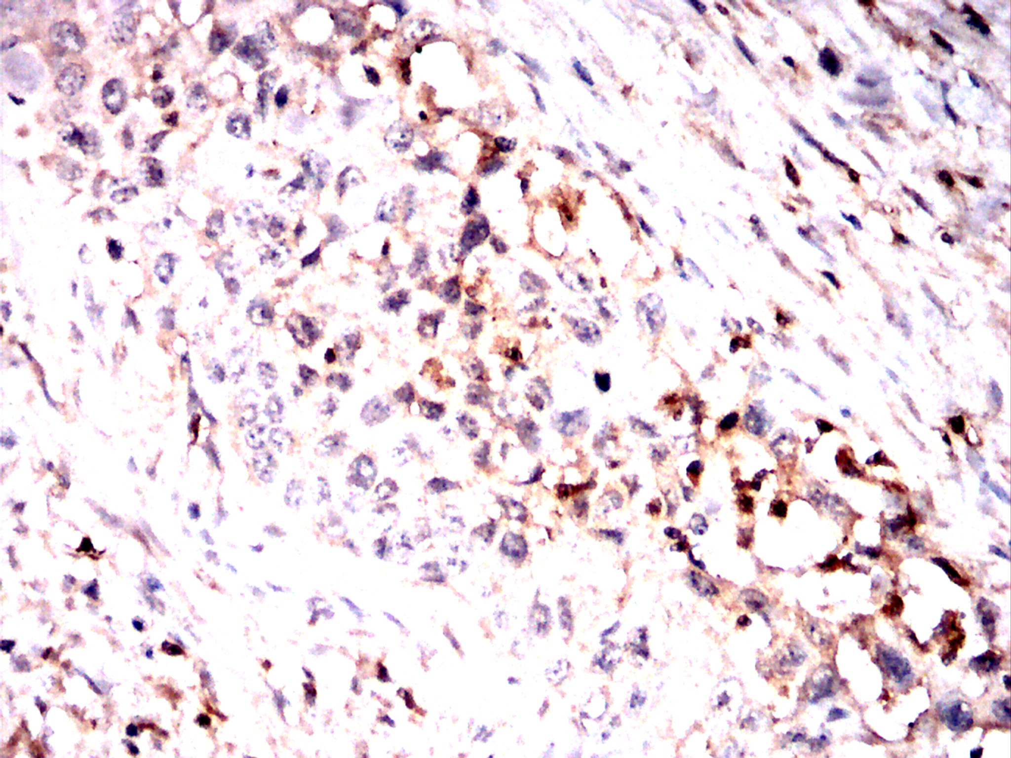 IHC 